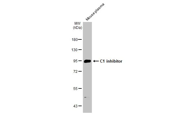 Mouse plasma (50 μg) was separated by 7.5% SDS-PAGE, and the membrane was blotted with C1 inhibitor antibody [C1C3] (GTX119690) diluted at 1:5000. The HRP-conjugated anti-rabbit IgG antibody (GTX213110-01) was used to detect the primary antibody.