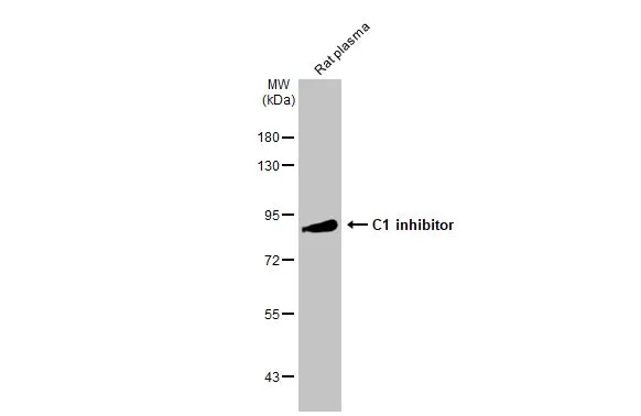 Rat plasma (50 μg) was separated by 7.5% SDS-PAGE, and the membrane was blotted with C1 inhibitor antibody [C1C3] (GTX119690) diluted at 1:5000. The HRP-conjugated anti-rabbit IgG antibody (GTX213110-01) was used to detect the primary antibody.