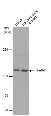 HeLa whole cell and nuclear extracts (30 μg) were separated by 5% SDS-PAGE, and the membrane was blotted with Rad50 antibody [N1N2], N-term (GTX119731) diluted at 1:500. The HRP-conjugated anti-rabbit IgG antibody (GTX213110-01) was used to detect the primary antibody.