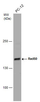 Whole cell extract (30 μg) was separated by 5% SDS-PAGE, and the membrane was blotted with Rad50 antibody [N1N2], N-term (GTX119731) diluted at 1:1000. The HRP-conjugated anti-rabbit IgG antibody (GTX213110-01) was used to detect the primary antibody.