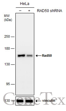 Non-transfected (–) and transfected (+) HeLa whole cell extracts (30 μg) were separated by 5% SDS-PAGE, and the membrane was blotted with Rad50 antibody [N1N2], N-term (GTX119731) diluted at 1:4000. The HRP-conjugated anti-rabbit IgG antibody (GTX213110-01) was used to detect the primary antibody.
