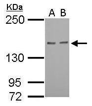 Rad50 antibody [N1N2],N-term detects RAD50 protein by western blot analysis.