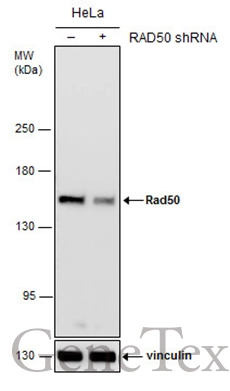 Non-transfected (–) and transfected (+) HeLa whole cell extracts (30 μg) were separated by 5% SDS-PAGE, and the membrane was blotted with Rad50 antibody [C1C2], Internal (GTX119732) diluted at 1:2000.