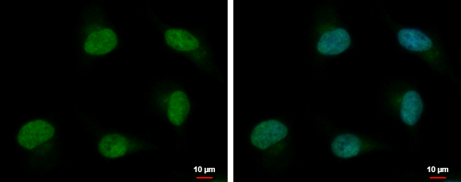 PSPC1 antibody detects PSPC1 protein at nucleus by immunofluorescent analysis.Sample: HeLa cells were fixed in 4% paraformaldehyde at RT for 15 min.Green: PSPC1 protein stained by PSPC1 antibody (GTX119744) diluted at 1:500.Blue: Hoechst 33342 staining.