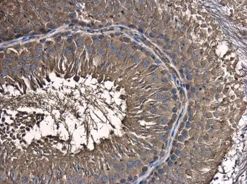 C18orf24 antibody detects C18orf24 protein at cytoplasm in rat testis by immunohistochemical analysis. Sample: Paraffin-embedded rat testis. C18orf24 antibody (GTX119803) diluted at 1:500. 
 Antigen Retrieval: Citrate buffer, pH 6.0, 15 min