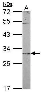Sample (50 μg of whole cell lysate) A: mouse liver 12% SDS PAGE GTX119821 diluted at 1:1000 The HRP-conjugated anti-rabbit IgG antibody (GTX213110-01) was used to detect the primary antibody.