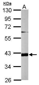 FAM46D antibody