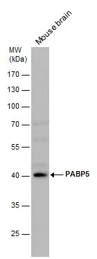 PABP5 antibody detects PABP5 protein by western blot analysis. Mouse tissue extracts (50 μg) was separated by 10 % SDS-PAGE, and the membrane was blotted with PABP5 antibody (GTX119883) diluted by 1:1000. PABP5 antibody detects PABP5 protein by western blot analysis. Mouse tissue extracts (50 μg) was separated by 10 % SDS-PAGE, and the membrane was blotted with PABP5 antibody (GTX119883) diluted by 1:1000.