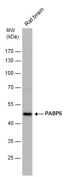 PABP5 antibody detects PABP5 protein by western blot analysis. Rat tissue extracts (50 μg) was separated by 10 % SDS-PAGE, and the membrane was blotted with PABP5 antibody (GTX119883) diluted by 1:1000.