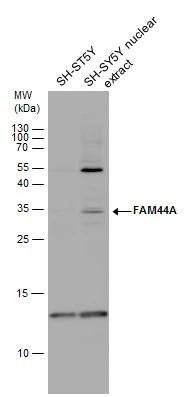 FAM44A antibody detects FAM44A protein by western blot analysis. SH-SY5Y whole cell extracts and nuclear extracts (30 μg) were separated by 15% SDS-PAGE, and the membrane was blotted with FAM44A antibody (GTX119946) diluted by 1:1000.