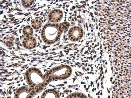 RPRD1B antibody detects RPRD1B protein at cytoplasm and nucleus in mouse cervix by immunohistochemical analysis. Sample: Paraffin-embedded mouse cervix. RPRD1B antibody (GTX119969) diluted at 1:500.
Antigen Retrieval: Trilogy? (EDTA based, pH 8.0) buffer, 15min RPRD1B antibody detects RPRD1B protein at cytoplasm and nucleus in mouse cervix by immunohistochemical analysis. Sample: Paraffin-embedded mouse cervix. RPRD1B antibody (GTX119969) diluted at 1:500.
Antigen Retrieval: Trilogy? (EDTA based, pH 8.0) buffer, 15min