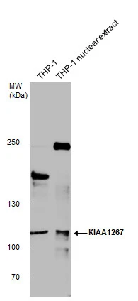 KIAA1267 antibody detects KIAA1267 protein by western blot analysis. THP-1 whole cell extracts and extracts (30 μg) were separated by 5% SDS-PAGE, and the membrane was blotted with KIAA1267 antibody (GTX120002) diluted at 1:500.