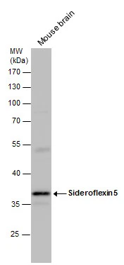 Sideroflexin 5 antibody detects Sideroflexin 5 protein by western blot analysis. Mouse tissue extracts (50 μg) was separated by 10 % SDS-PAGE, and the membrane was blotted with Sideroflexin 5 antibody (GTX120024) diluted by 1:1000.