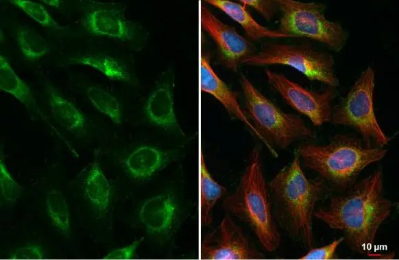CKAP4 antibody [N3C3] detects CKAP4 protein at endoplasmic reticulum by immunofluorescent analysis. Sample: HeLa cells were fixed in ice-cold MeOH for 5 min. Green: CKAP4 stained by CKAP4 antibody [N3C3] (GTX120087) diluted at 1:1000. Red: alpha Tubulin, a cytoskeleton marker, stained by alpha Tubulin antibody [GT114] (GTX628802) diluted at 1:1000. Blue: Fluoroshield with DAPI (GTX30920).