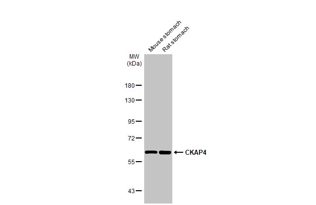 Various tissue extracts (50 μg) were separated by 7.5% SDS-PAGE, and the membrane was blotted with CKAP4 antibody [N3C3] (GTX120087) diluted at 1:1000. The HRP-conjugated anti-rabbit IgG antibody (GTX213110-01) was used to detect the primary antibody.