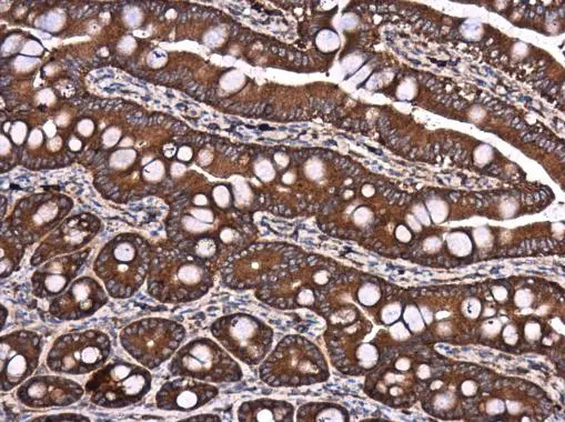 DYNC1LI1 antibody detects DYNC1LI1 protein at cytoplasm in rat intestine by immunohistochemical analysis. Sample: Paraffin-embedded rat intestine. DYNC1LI1 antibody (GTX120114) diluted at 1:500. 
 Antigen Retrieval: Citrate buffer, pH 6.0, 15 min