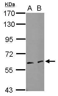 Sample (50 ug of whole cell lysate) A: mouse brown adipose B: mouse white adipose 7.5% SDS PAGE GTX120119 diluted at 1:1000