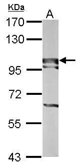 Sample (50 ug of whole cell lysate) A: mouse liver 7.5% SDS PAGE GTX120120 diluted at 1:1000