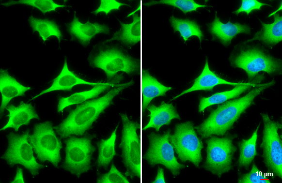 ZC3HAV1 antibody [N3C2], Internal detects ZC3HAV1 protein at cytoplasm by immunofluorescent analysis. Sample: HeLa cells were fixed in 4% paraformaldehyde at RT for 15 min. Green: ZC3HAV1 stained by ZC3HAV1 antibody [N3C2], Internal (GTX120134) diluted at 1:1000. Blue: Fluoroshield with DAPI (GTX30920). Scale bar= 10 μm.