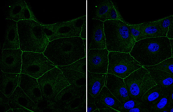 CGN antibody