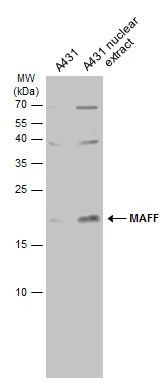 A431 whole cell and nuclear extracts (30 μg) were separated by 15% SDS-PAGE, and the membrane was blotted with MAFF antibody (GTX120264) diluted at 1:500. The HRP-conjugated anti-rabbit IgG antibody (GTX213110-01) was used to detect the primary antibody.