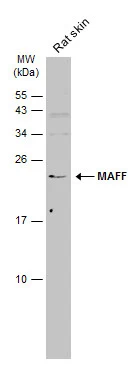 Rat tissue extract (50 μg) was separated by 15% SDS-PAGE, and the membrane was blotted with MAFF antibody (GTX120264) diluted at 1:500. The HRP-conjugated anti-rabbit IgG antibody (GTX213110-01) was used to detect the primary antibody.
