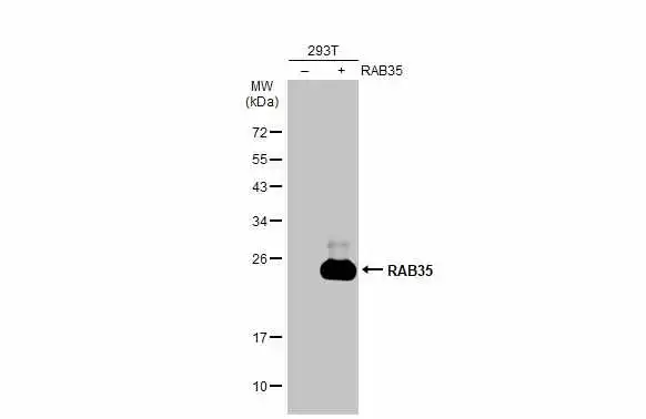 Non-transfected (–) and transfected (+) 293T whole cell extracts (30 μg) were separated by 12% SDS-PAGE, and the membrane was blotted with RAB35 antibody [N1C3] (GTX120294) diluted at 1:2000. The HRP-conjugated anti-rabbit IgG antibody (GTX213110-01) was used to detect the primary antibody.