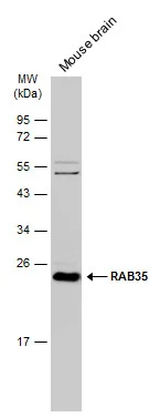 Mouse tissue extract (50 μg) was separated by 12% SDS-PAGE, and the membrane was blotted with RAB35 antibody [N1C3] (GTX120294) diluted at 1:1000. The HRP-conjugated anti-rabbit IgG antibody (GTX213110-01) was used to detect the primary antibody.