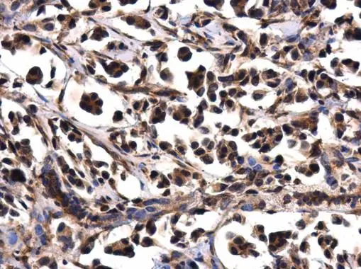 WDYHV1 antibody