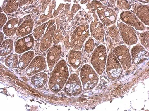 Nop25 antibody detects Nop25 protein at nucleous on mouse intestine by immunohistochemical analysis. Sample: Paraffin-embedded mouse intestine. Nop25 antibody (GTX120303) dilution: 1:500.
Antigen Retrieval: Trilogy? (EDTA based, pH 8.0) buffer, 15min