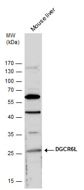 DGCR6L antibody detects DGCR6L protein by western blot analysis. Mouse tissue extracts (50 μg) was separated by 12 % SDS-PAGE, and the membrane was blotted with DGCR6L antibody (GTX120306) diluted by 1:1000. DGCR6L antibody detects DGCR6L protein by western blot analysis. Mouse tissue extracts (50 μg) was separated by 12 % SDS-PAGE, and the membrane was blotted with DGCR6L antibody (GTX120306) diluted by 1:1000.