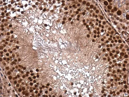 DNTTIP1 antibody detects DNTTIP1 protein at nucleus in rat testis by immunohistochemical analysis. Sample: Paraffin-embedded rat testis. DNTTIP1 antibody (GTX120392) diluted at 1:500. 
 Antigen Retrieval: Citrate buffer, pH 6.0, 15 min