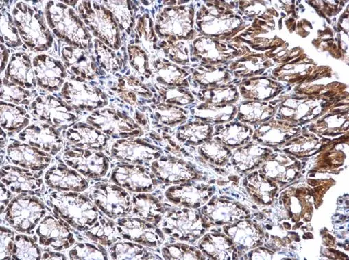 DNTTIP1 antibody detects DNTTIP1 protein at nucleus on mouse colon by immunohistochemical analysis. Sample: Paraffin-embedded mouse colon. DNTTIP1 antibody (GTX120392) dilution: 1:1000. 
 Antigen Retrieval: Trilogy? (EDTA based, pH 8.0) buffer, 15min