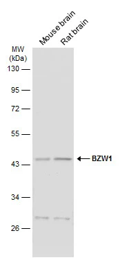 Various tissue extracts (50 μg) were separated by 10% SDS-PAGE, and the membrane was blotted with BZW1 antibody (GTX120426) diluted at 1:1000. The HRP-conjugated anti-rabbit IgG antibody (GTX213110-01) was used to detect the primary antibody.
