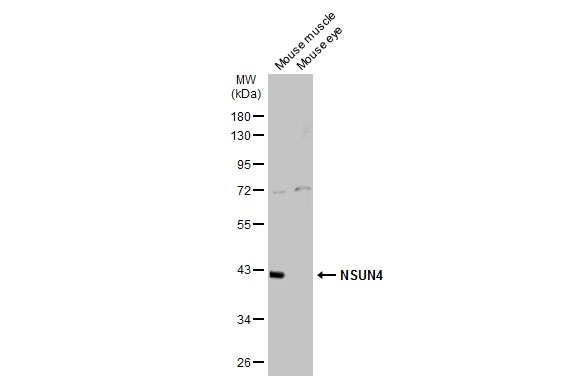 Various tissue extracts (50 μg) were separated by 10% SDS-PAGE, and the membrane was blotted with NSUN4 antibody [N1C2] (GTX120442) diluted at 1:1000. The HRP-conjugated anti-rabbit IgG antibody (GTX213110-01) was used to detect the primary antibody, and the signal was developed with Trident ECL plus-Enhanced.