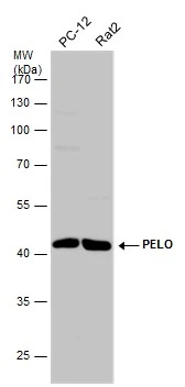 Various whole cell extracts (30 μg) were separated by 10% SDS-PAGE, and the membrane was blotted with PELO antibody (GTX120446) diluted at 1:1000. The HRP-conjugated anti-rabbit IgG antibody (GTX213110-01) was used to detect the primary antibody.