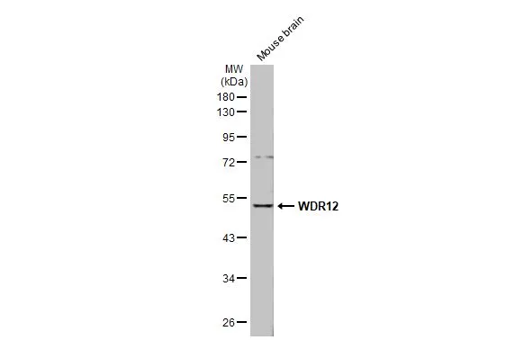 Mouse tissue extract (50 μg) was separated by 10% SDS-PAGE, and the membrane was blotted with WDR12 antibody [N1C2] (GTX120474) diluted at 1:1000. The HRP-conjugated anti-rabbit IgG antibody (GTX213110-01) was used to detect the primary antibody, and the signal was developed with Trident ECL plus-Enhanced.