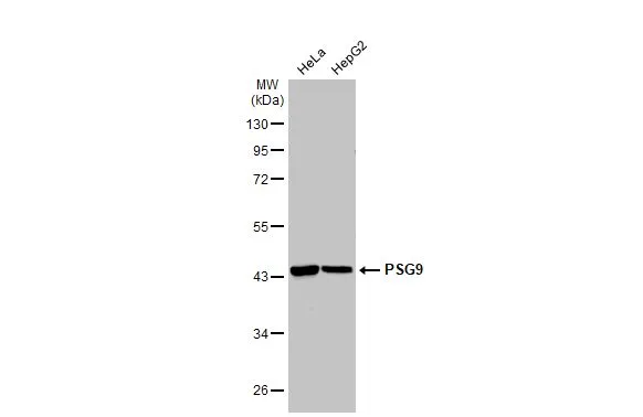 Various whole cell extracts (30 μg) were separated by 10% SDS-PAGE, and the membrane was blotted with PSG9 antibody [C1C3] (GTX120479) diluted at 1:5000. The HRP-conjugated anti-rabbit IgG antibody (GTX213110-01) was used to detect the primary antibody.