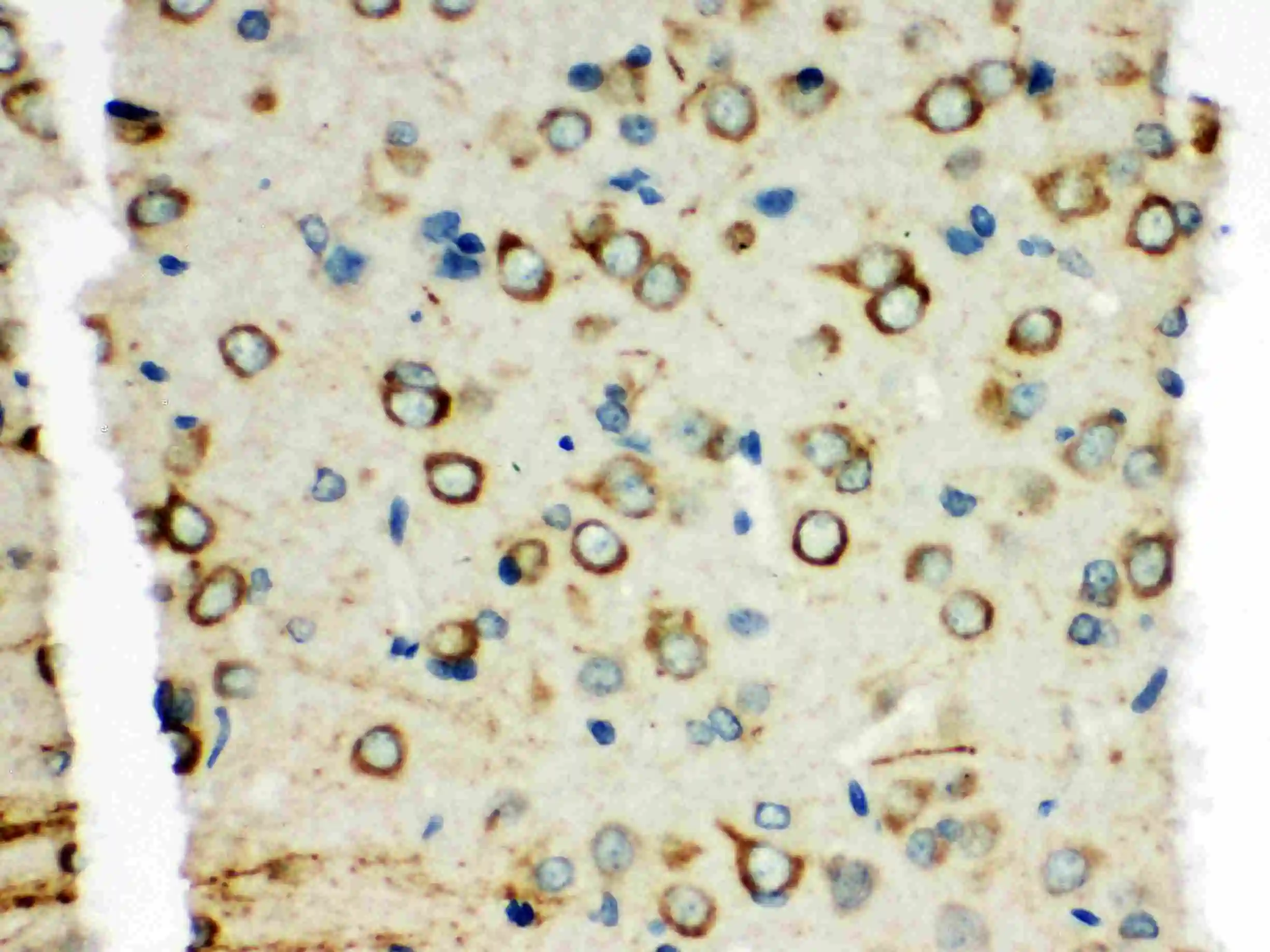 IHC-P analysis of rat brain tissue using GTX12050 XRCC3 antibody. Antigen retireval : Heat mediated antigen retrieval was performed in citrate buffer (pH6, epitope retrieval solution) for 20 mins Dilution : 1microg/ml IHC-P analysis of rat brain tissue using GTX12050 XRCC3 antibody. Antigen retireval : Heat mediated antigen retrieval was performed in citrate buffer (pH6, epitope retrieval solution) for 20 mins Dilution : 1microg/ml