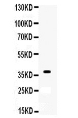 WB analysis of mouse brain tissue lysate using GTX12050 XRCC3 antibody. Dilution : 0.5 microg/mL Loading : 50microg of sample under reducing conditions