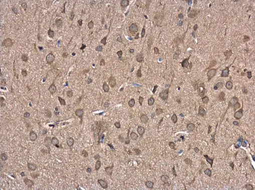 FBXL16 antibody [N2C3] detects FBXL16 protein at cytoplasm in rat brain by immunohistochemical analysis. Sample: Paraffin-embedded rat brain. FBXL16 antibody [N2C3] (GTX120503) diluted at 1:500. 
 Antigen Retrieval: Citrate buffer, pH 6.0, 15 min