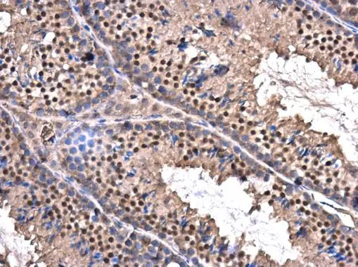ZBTB5 antibody detects ZBTB5 protein at nucleus in mouse testis by immunohistochemical analysis. Sample: Paraffin-embedded mouse testis. ZBTB5 antibody (GTX120612) diluted at 1:500. Antigen Retrieval: Citrate buffer, pH 6.0, 15 min