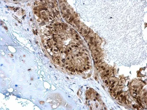 ZBTB5 antibody detects ZBTB5 protein at nucleus and cytosol on mouse prostate by immunohistochemical analysis. Sample: Paraffin-embedded mouse prostate. ZBTB5 antibody (GTX120612) dilution: 1:1000. Antigen Retrieval: Trilogy? (EDTA based, pH 8.0) buffer, 15min
