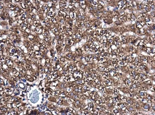 SMPD4 antibody detects SMPD4 protein at cytoplasm in rat liver by immunohistochemical analysis. Sample: Paraffin-embedded rat liver. SMPD4 antibody (GTX120642) diluted at 1:500. 
 Antigen Retrieval: Citrate buffer, pH 6.0, 15 min