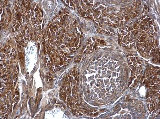 SMPD4 antibody detects SMPD4 protein at cytosol on mouse ovary by immunohistochemical analysis. Sample: Paraffin-embedded mouse ovary. SMPD4 antibody (GTX120642) dilution: 1:500. 
 Antigen Retrieval: Trilogy? (EDTA based, pH 8.0) buffer, 15min