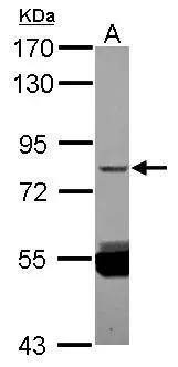 Sample (30 ug of whole cell lysate) A: NT2D1 7.5% SDS PAGE GTX120643 diluted at 1:1000 