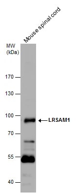 LRSAM1 antibody detects LRSAM1 protein by western blot analysis. Mouse tissue extracts (50 μg) was separated by 7.5 % SDS-PAGE, and the membrane was blotted with LRSAM1 antibody (GTX120647) diluted by 1:2000.