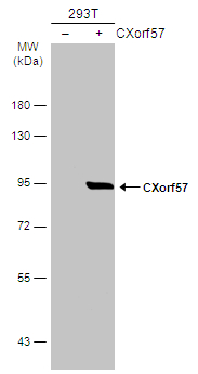 Non-transfected (–) and transfected (+) 293T whole cell extracts (30 μg) were separated by 7.5% SDS-PAGE, and the membrane was blotted with CXorf57 antibody (GTX120687) diluted at 1:5000. The HRP-conjugated anti-rabbit IgG antibody (GTX213110-01) was used to detect the primary antibody.