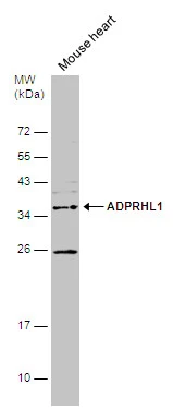 Mouse tissue extract (50 μg) was separated by 12% SDS-PAGE, and the membrane was blotted with ADPRHL1 antibody (GTX120706) diluted at 1:500.
