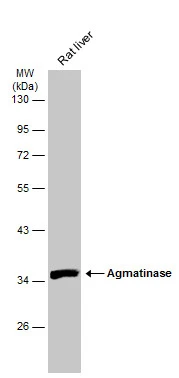 Rat tissue extract (50 μg) was separated by 10% SDS-PAGE, and the membrane was blotted with Agmatinase antibody (GTX120707) diluted at 1:1000. The HRP-conjugated anti-rabbit IgG antibody (GTX213110-01) was used to detect the primary antibody.